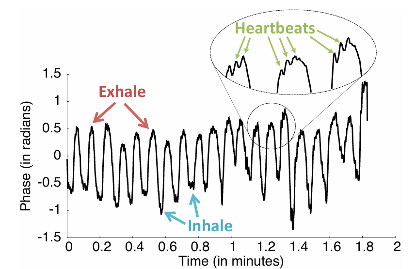 Time-series plot of unwrapped radar phase showing breathing oscillation with smaller heartbeat ripples superimposed.